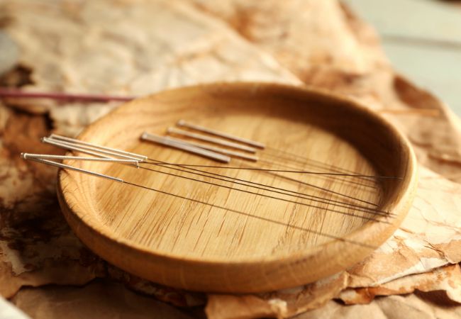 How to Prepare for an Acupuncture Session for the first time